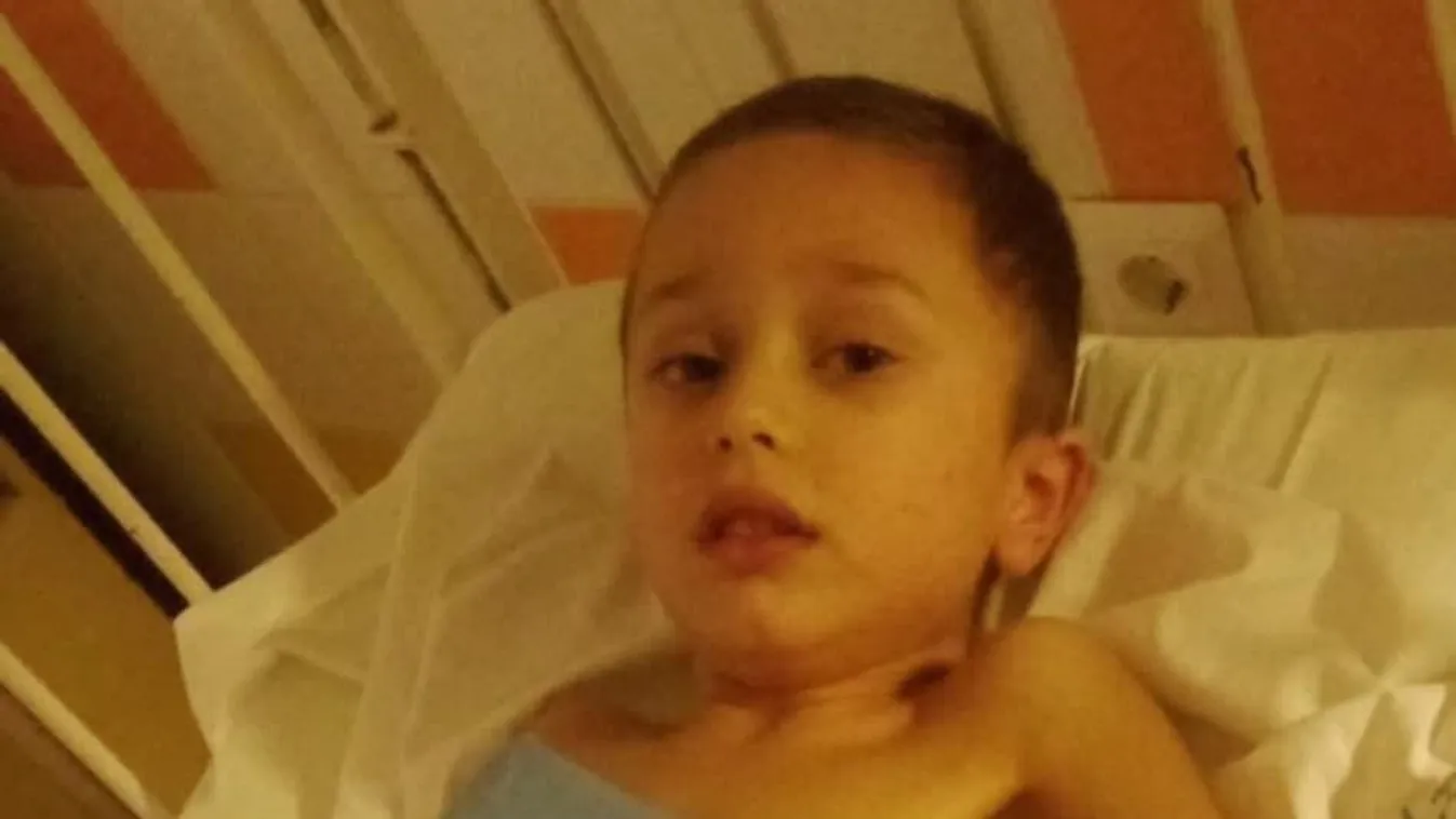 Fellélegezhet a család: így van most a forró vízbe esett fiú