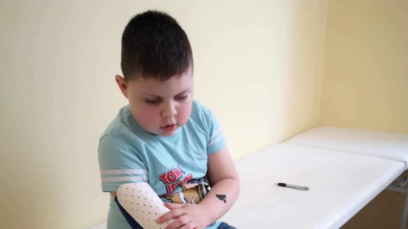 Barcelonában kaphat új esélyt az életre a 10 éves Benett