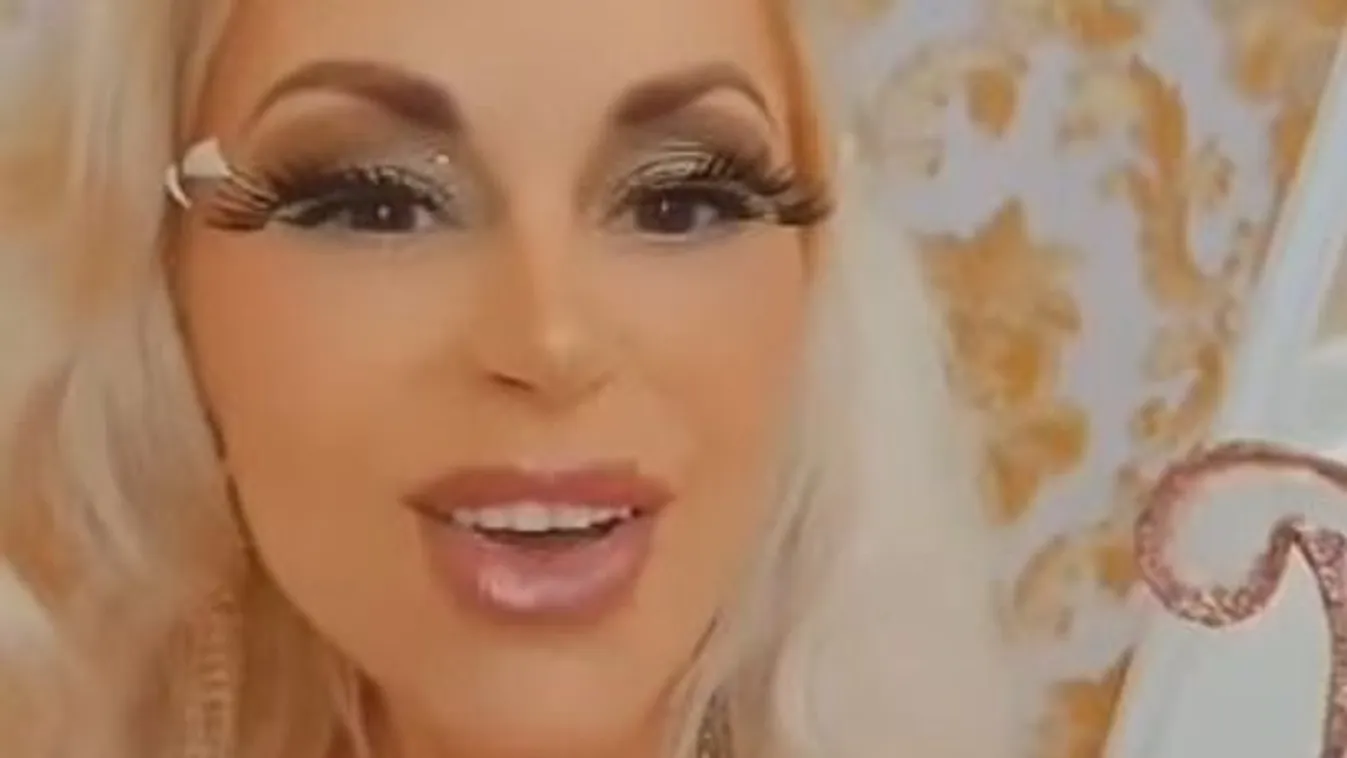 "Mások zsírját fecskendezik az arcomba, hogy örökre fiatal maradjak"