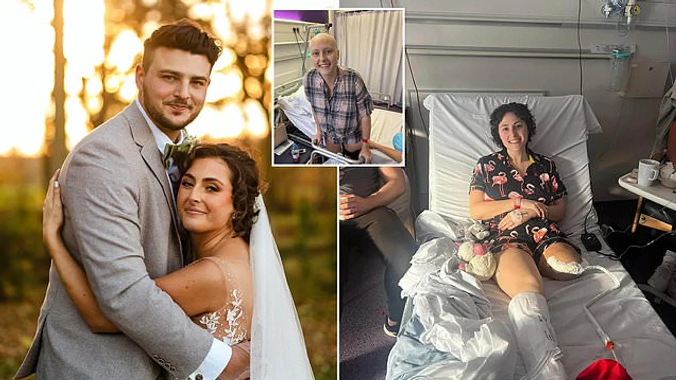 Feláldozta a lábát, hogy legyőzze a rákot a 28 éves nő