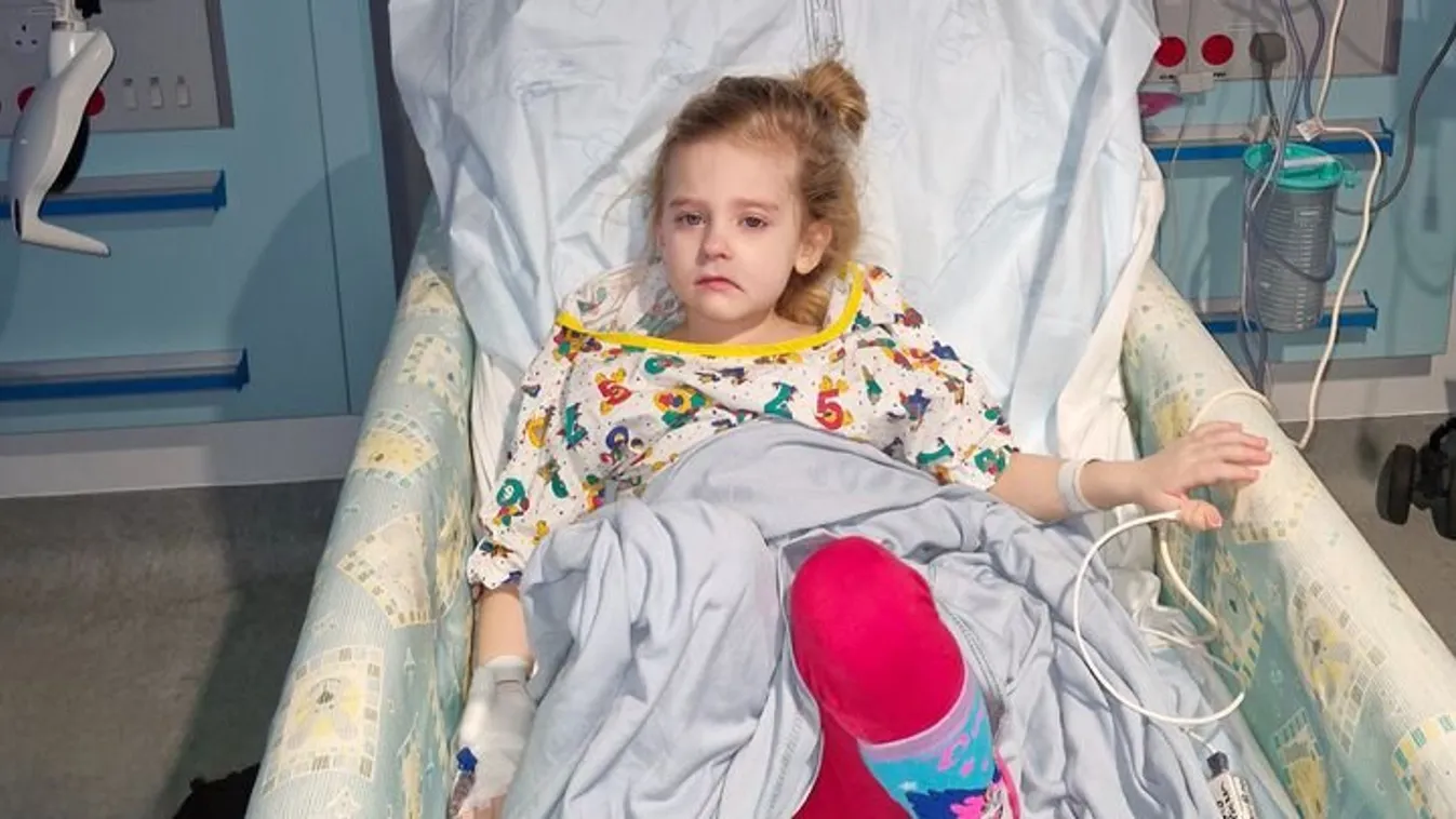 Bedagadt az esés után a 9 hónapos lány arca, rák volt