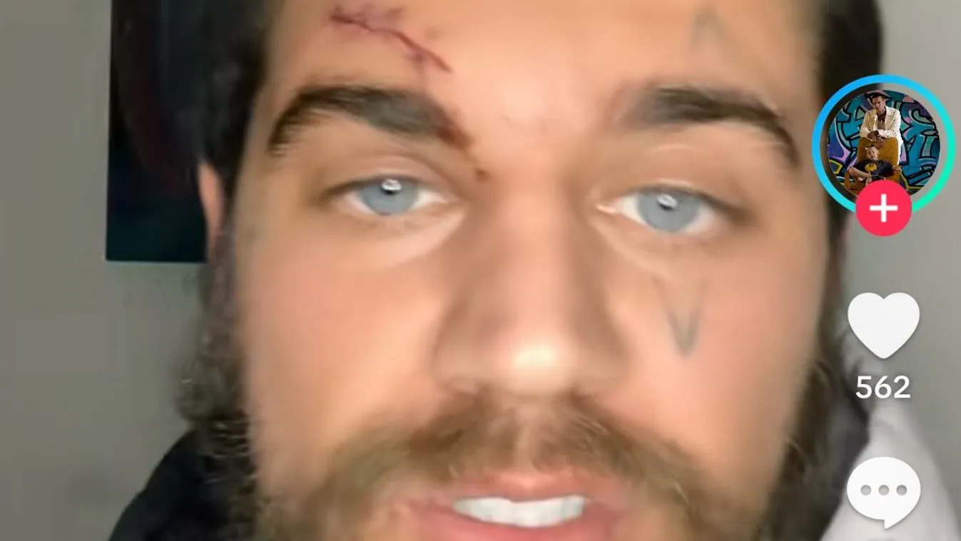 Mandula Ádám mindent tagad az újabb balhé kapcsán