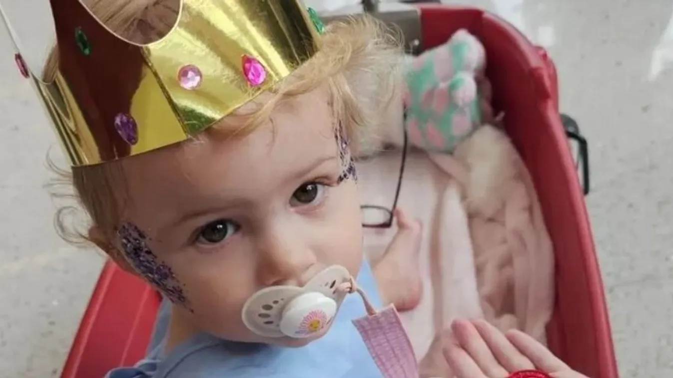 Szívszorító: 2 éves kislány küzd az életéért
