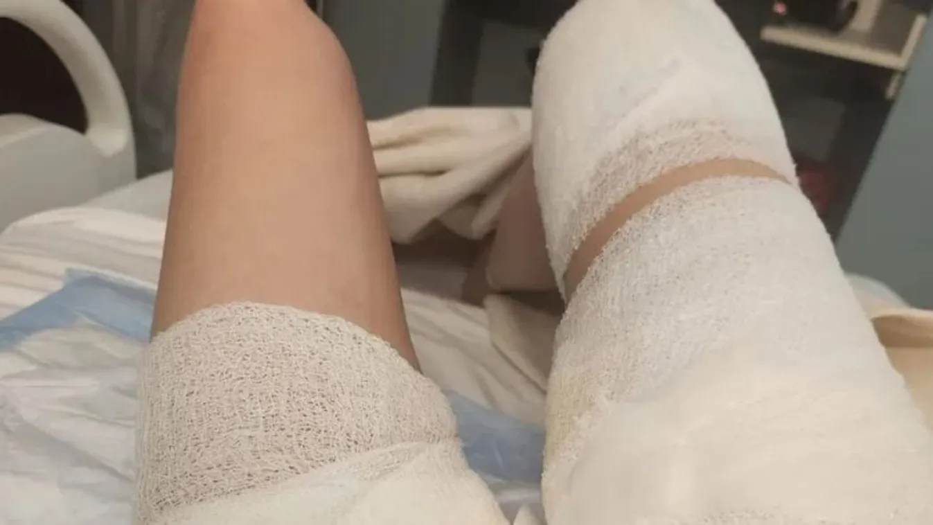 "Úgy néztem ki, mintha egy zombi támadott volna meg"