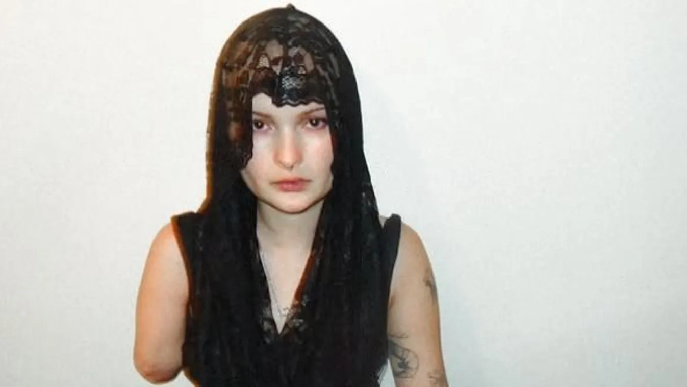 Temetést rendezett amputált karjának a fiatal influenszer