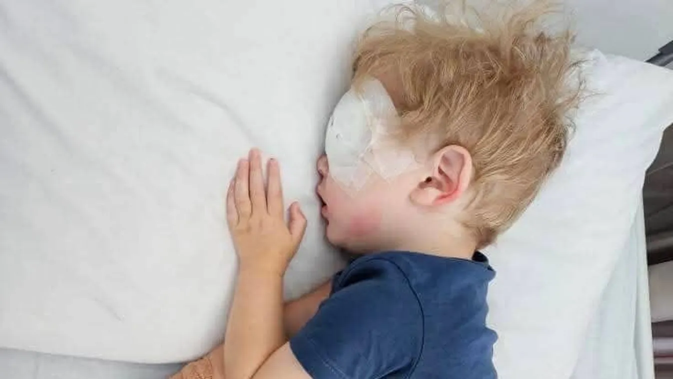 Egyetlen puszi miatt vakulhat meg teljesen egy kisfiú