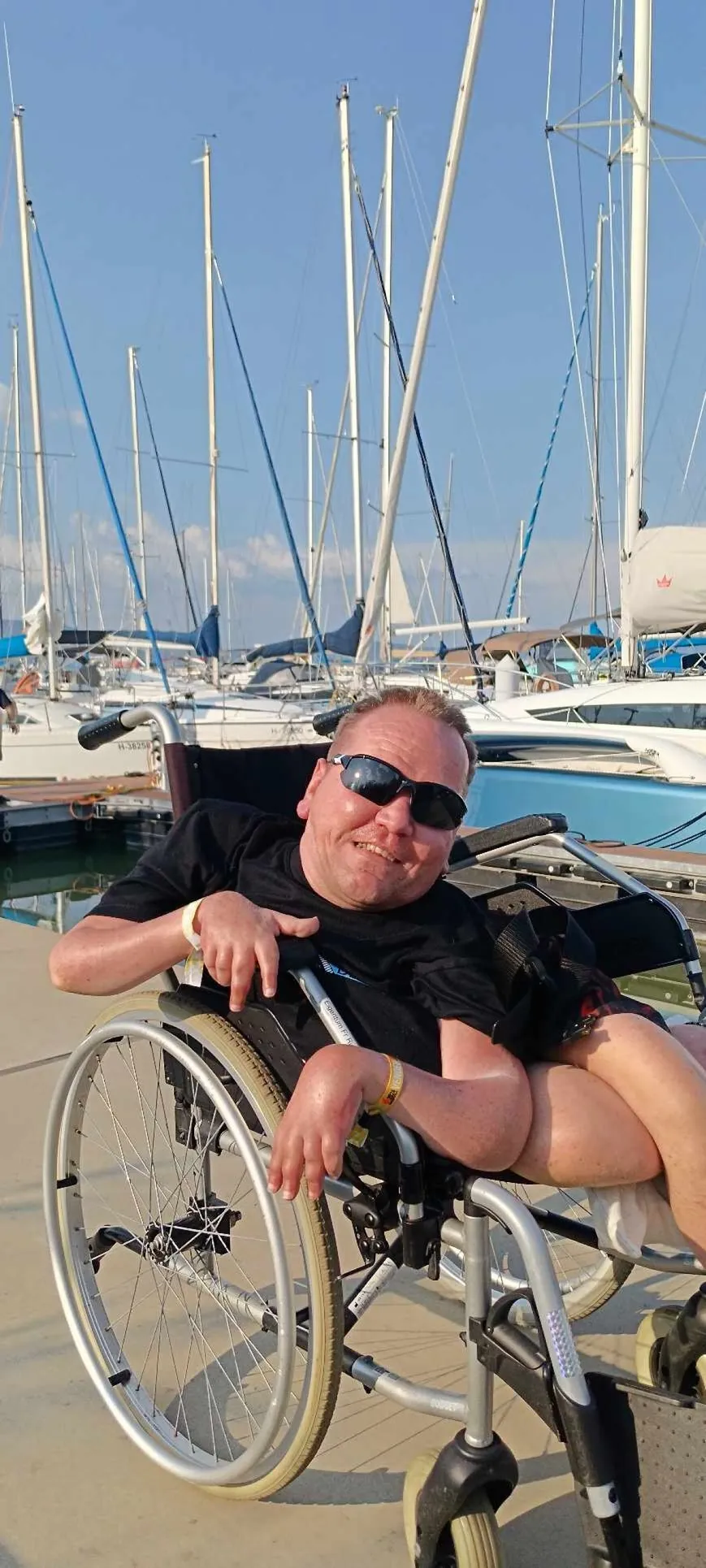 Peres Roland Sarkadon él, és izomsorvadással látta meg a napvilágot. 