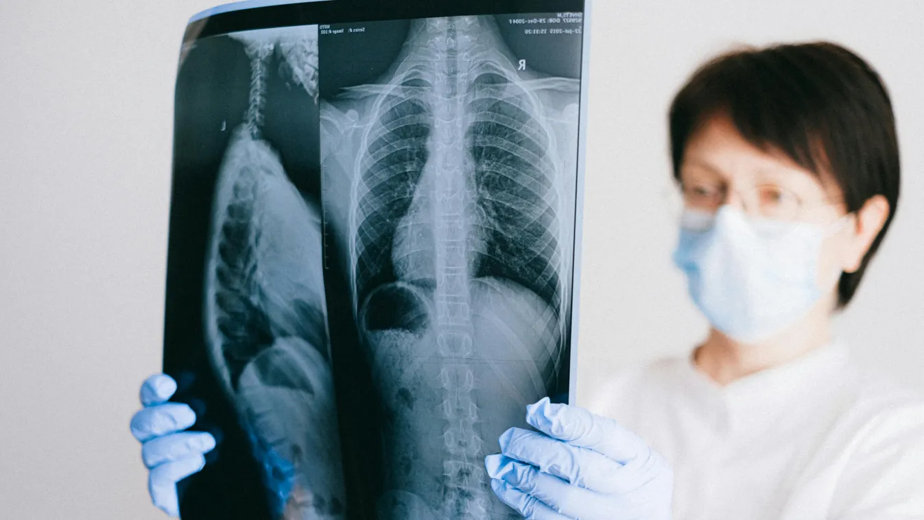 Kiszaladt a vér az orvosok arcából, amikor rájöttek, mi van a férfi fenekében