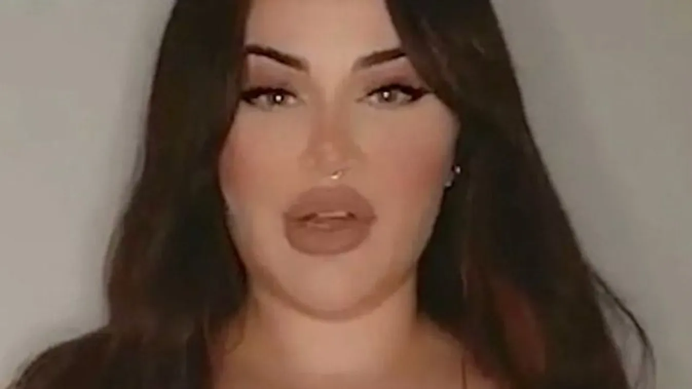 Hatalmas mellei miatt kritizálják az emberek