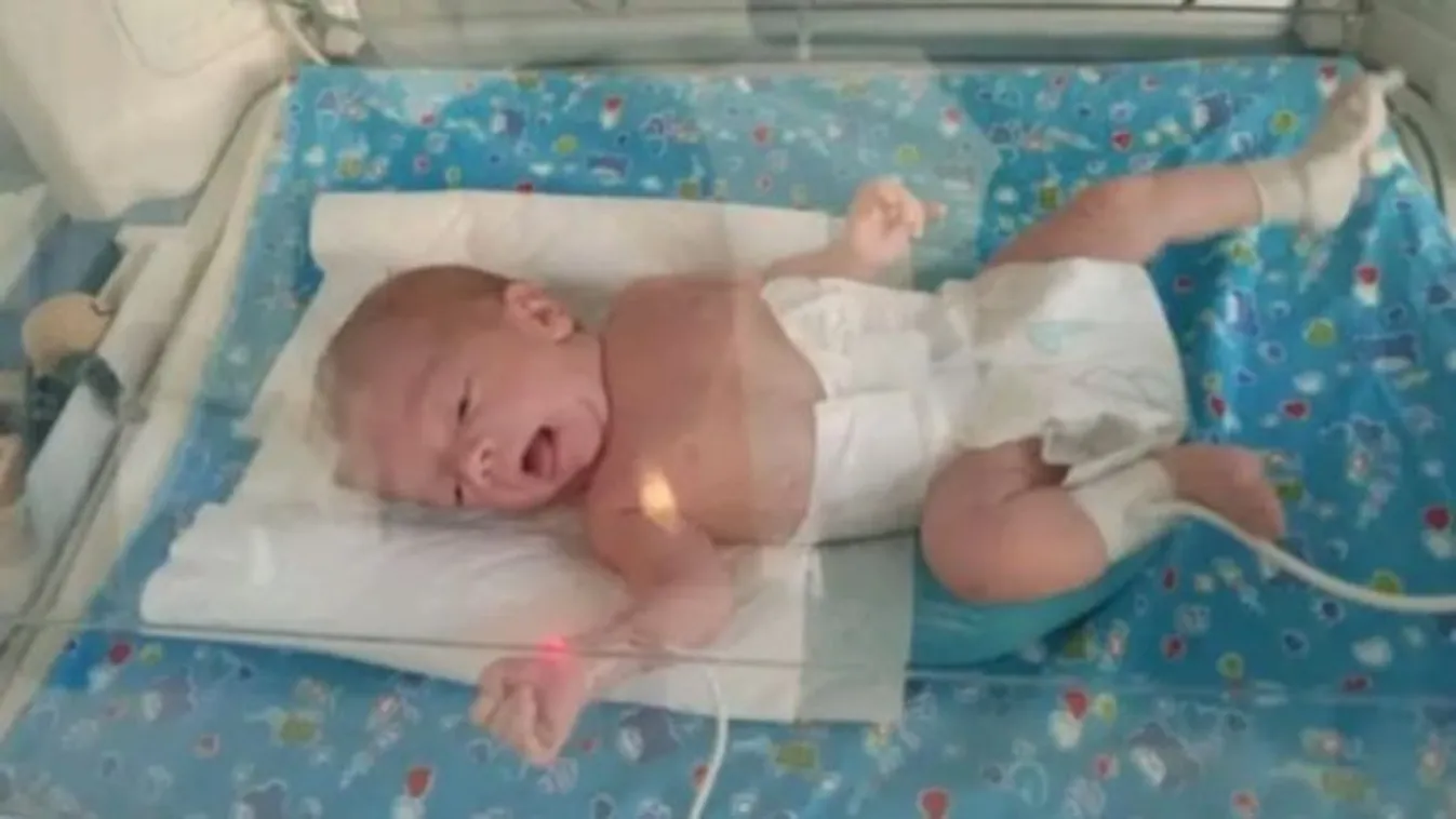 Életveszélyben a kis Dominik: 4 ciszta növekszik a fejében