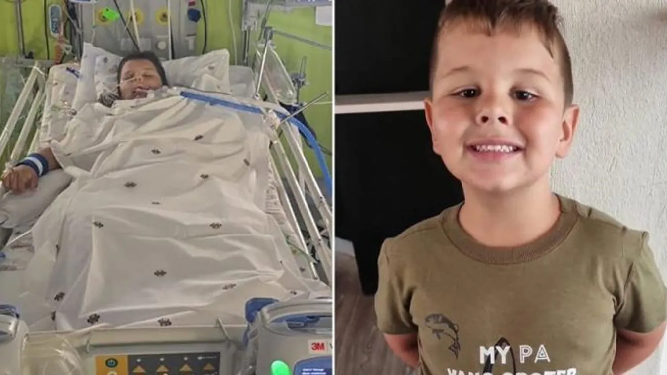 Vadállat támadt egy 7 évesre, elvesztette jobb kezét