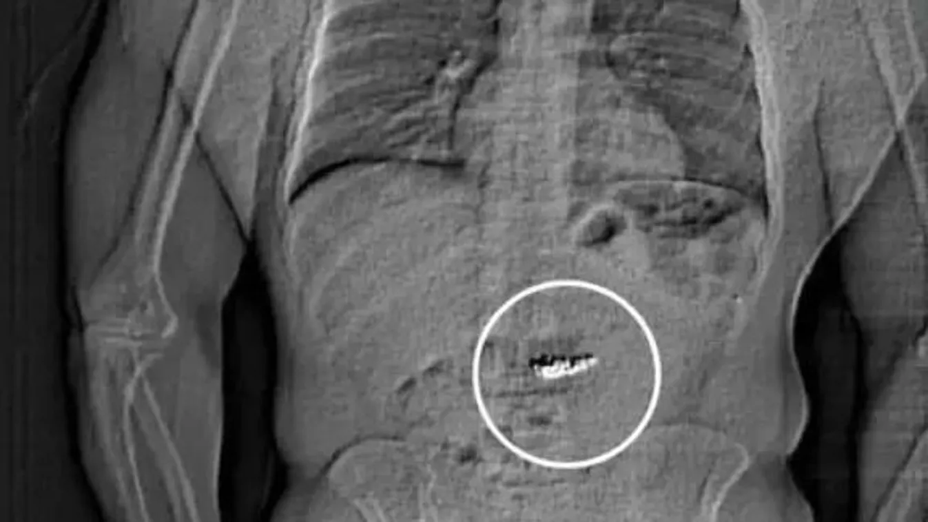 280 millió forint értékű gyémántot nyelt le egy ékszertolvaj