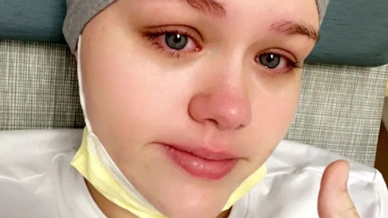 „Meg fogok halni” - Öregemberkórsággal küzd a 17 éves lány