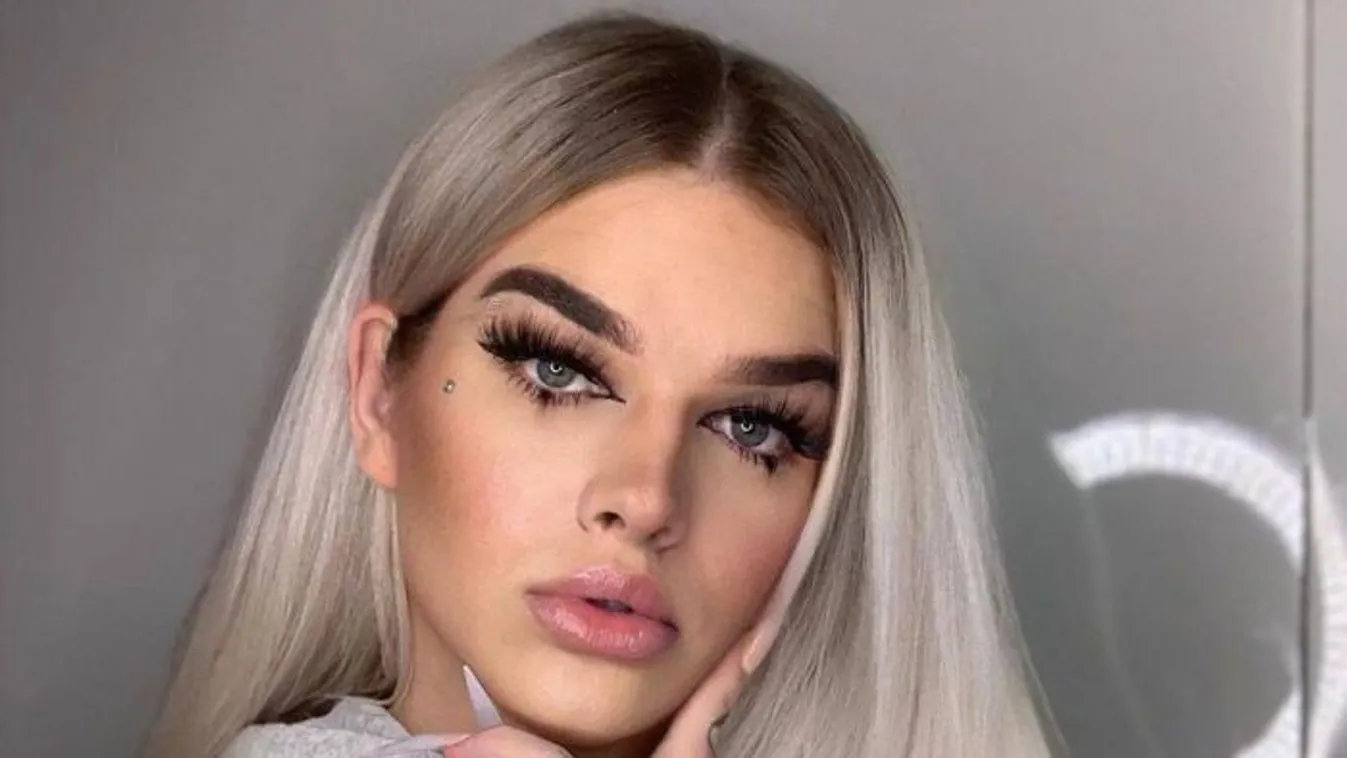 16 napon túl gyógyulnak Bish Bharbie sérülései