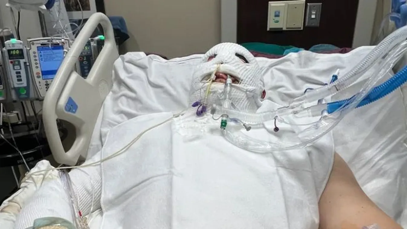 Élet és halál között lebeg egy édesapa