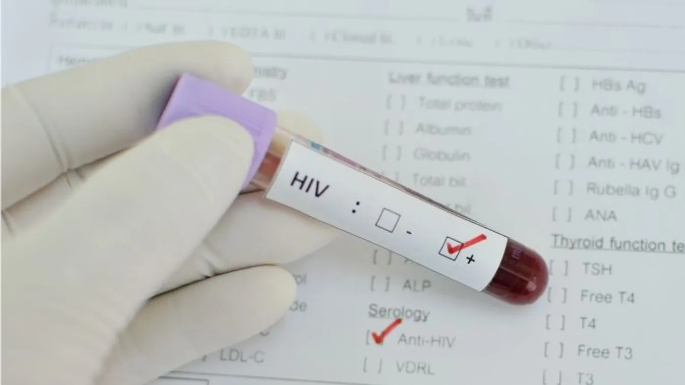 HIV-járvány terjed Ukrajnában