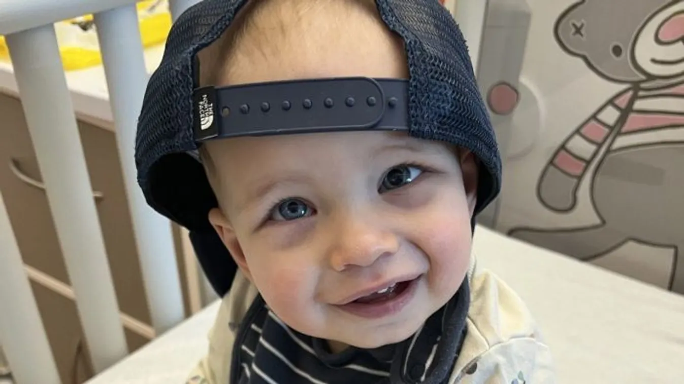 Ritka betegséget fedeztek fel egy baba szemében