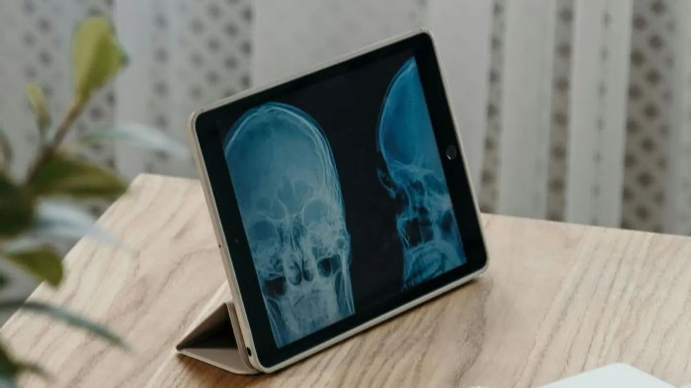 Arcüreggyulladásnak hitte, óriásit tévedett a férfi