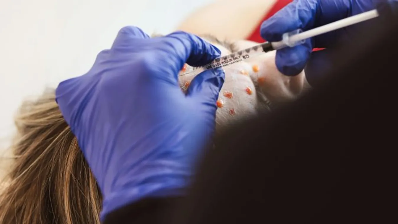 Plasztikai műtétre volt szüksége egy tehéntámadás után