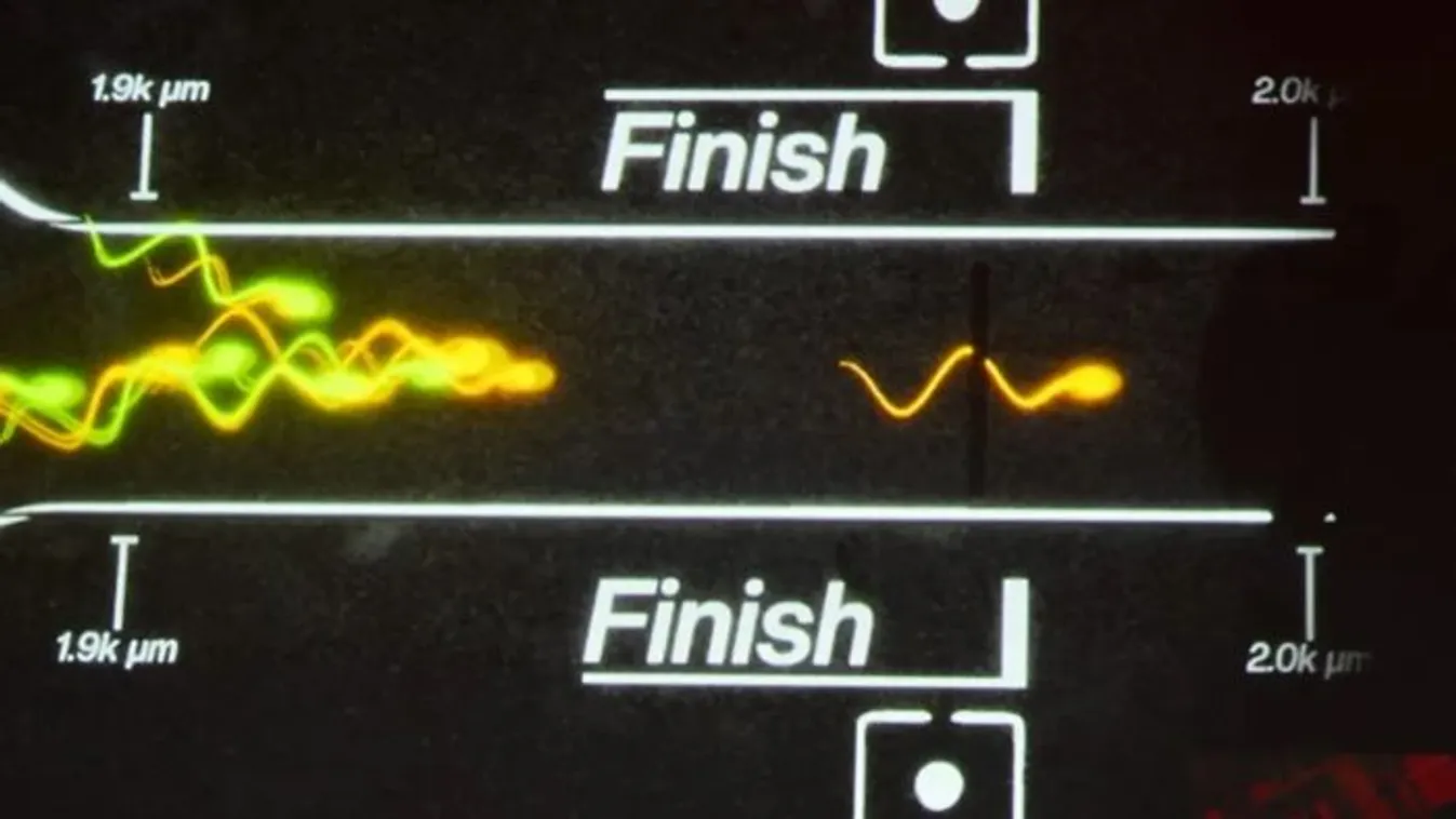 Megrendezték a világ első hímivarsejt "futóversenyét"