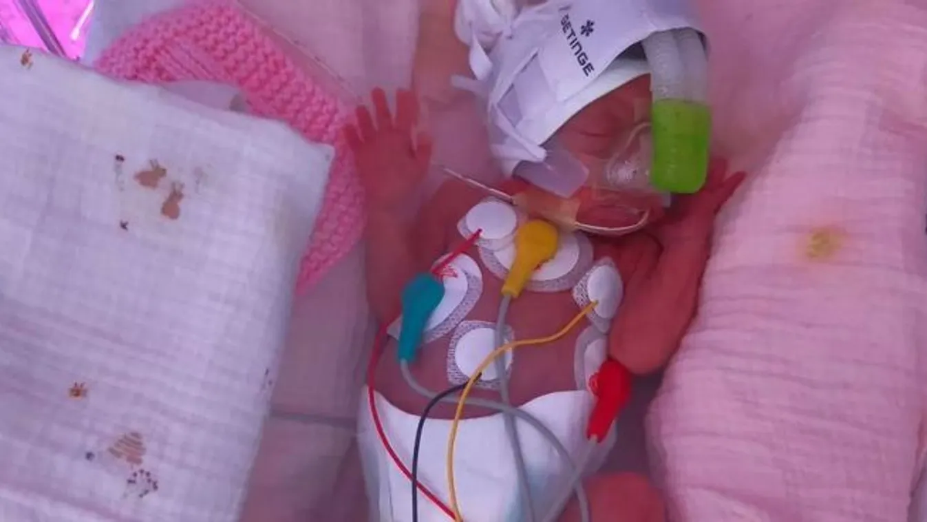 15 héttel korábban jött világra ez a tündéri kislány