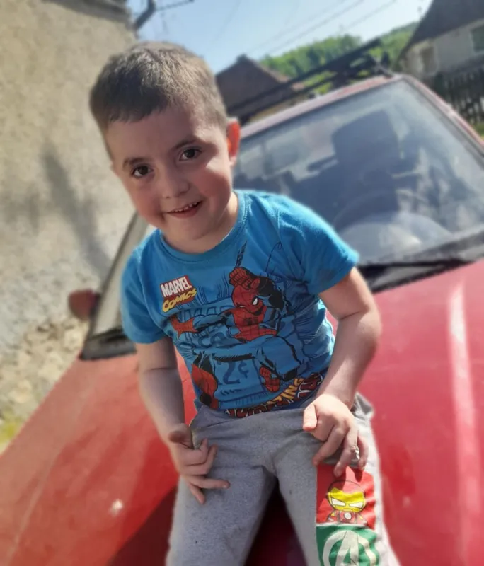 Dongalábbal jött a világra az Aggtelek melletti Trizsen élő öt éves Dányi Tomika. Egy éves korában genetikai vizsgálaton vett részt a gyermek, ahol megállapították az orvosok, hogy duchenne izomdisztrófiában is szenved.