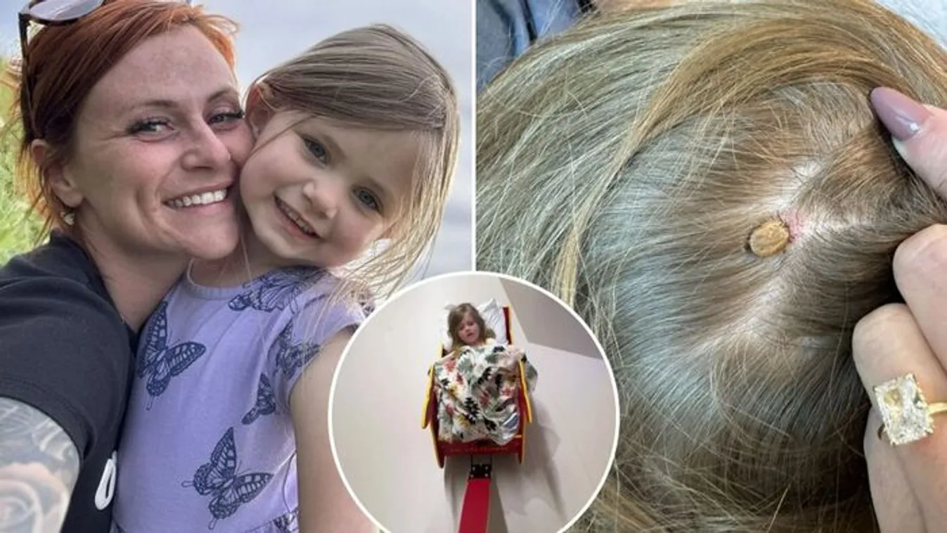 Teljesen egészséges 4 éves lány lebénult a családi kempingen