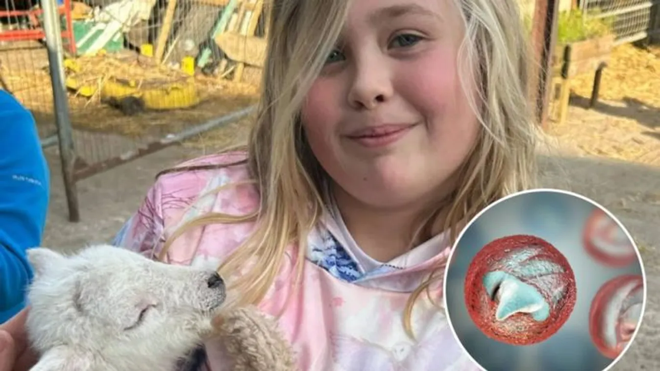 Kis híján az életével fizetett a bárányetetésért a 8 éves