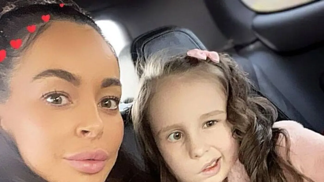 Eperallergiának hitték az orvosok: agydaganattal küzd az 5 éves kislány