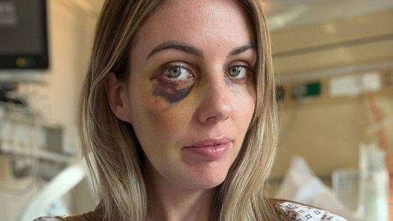 Kis híján belehalt egy édesanya a fogamzásgátló mellékhatásaiba