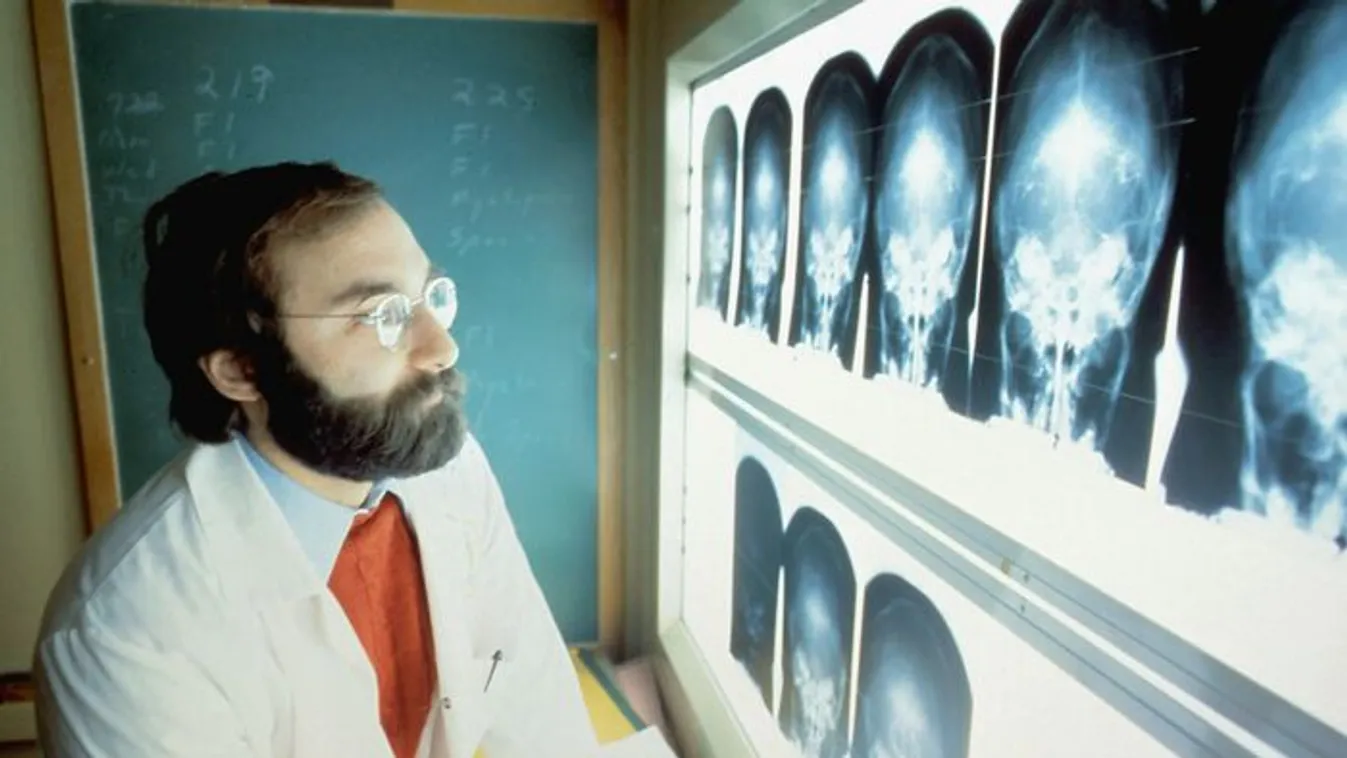 Így segíthet a sugárterápia a rák elleni harcban