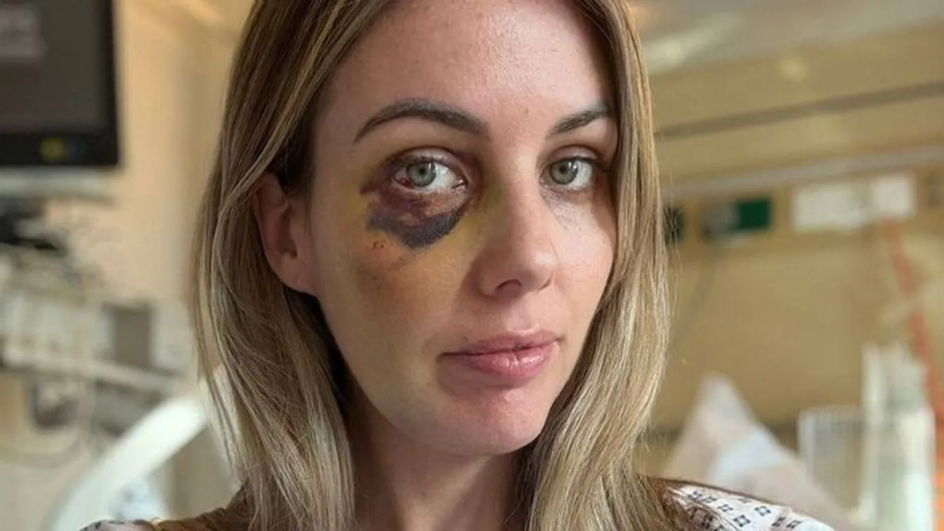 Majdnem belehalt egy anya a fogamzásgátló mellékhatásaiba