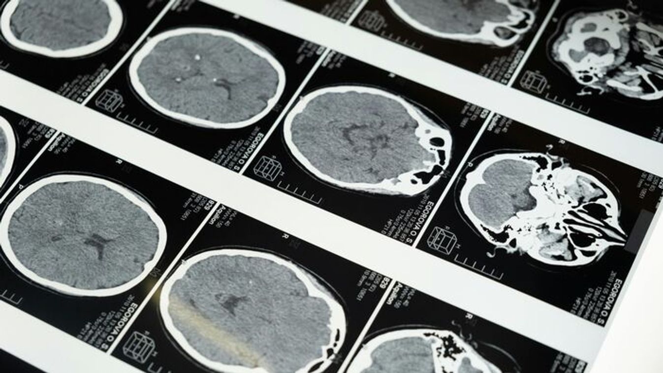 A halál pillanata: ez történik velünk életünk utolsó másodperceiben