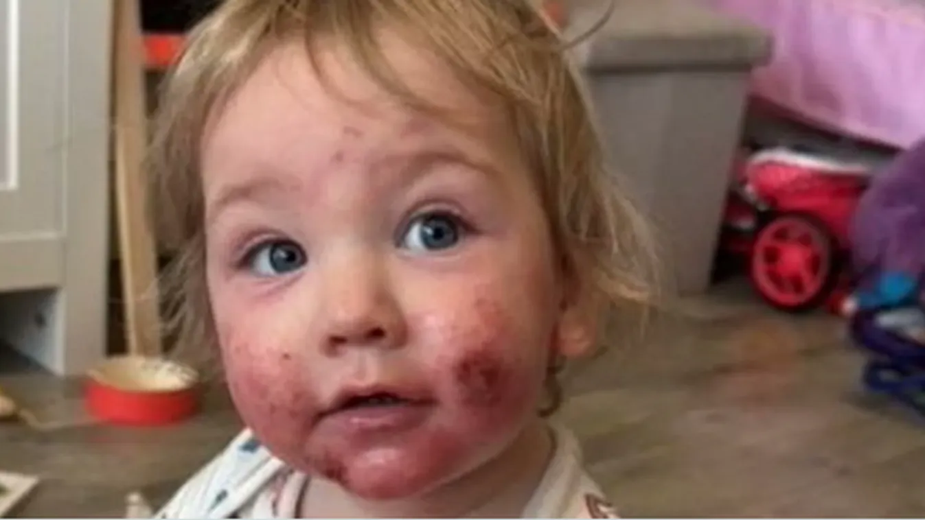 Ordít a fájdalomtól a kisbaba, ha hozzáérnek