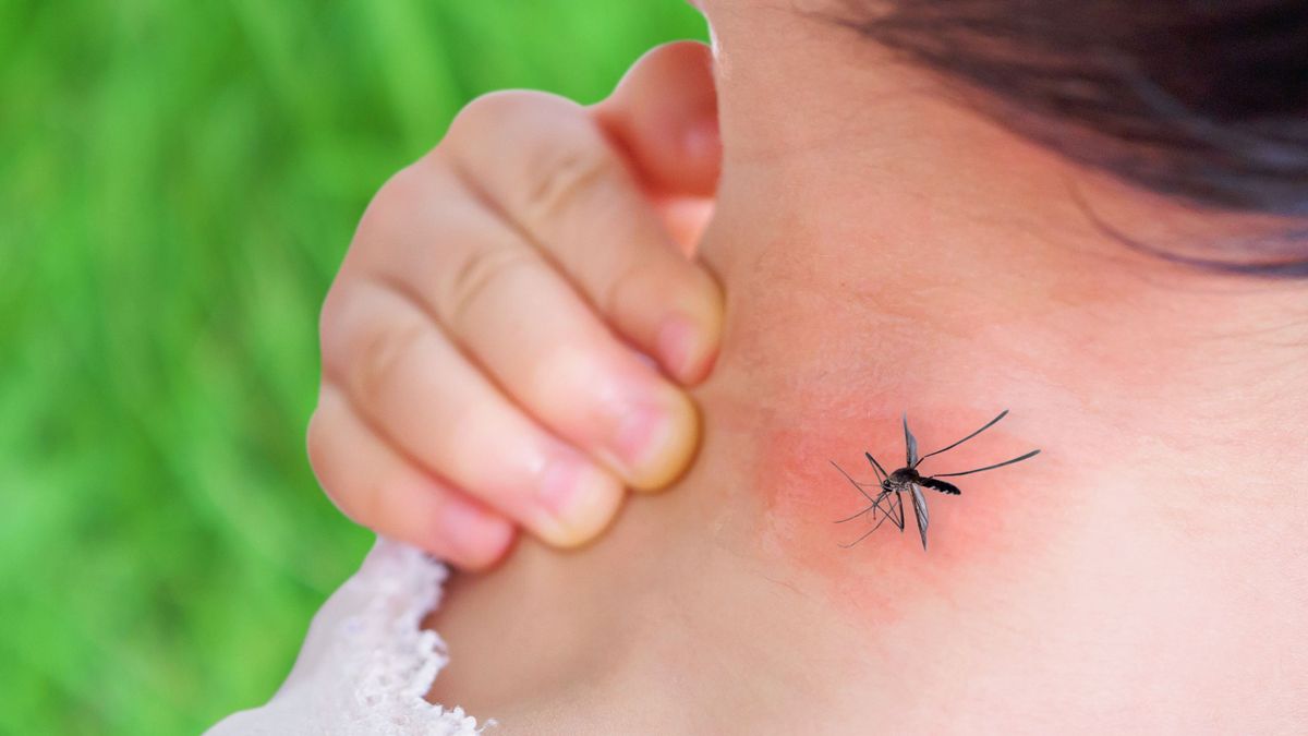 Így segít a szódabikarbóna, ha megcsípett a szúnyog