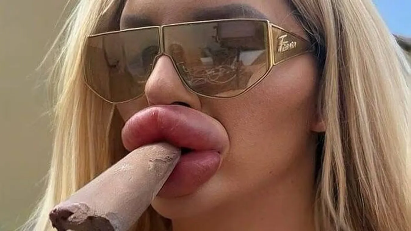 "Nem tudom már becsukni a számat az ajakfeltöltés miatt"