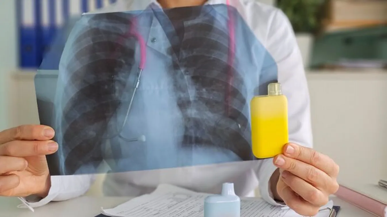 Így pusztítja le a tüdődet az elektromos cigi - Videó