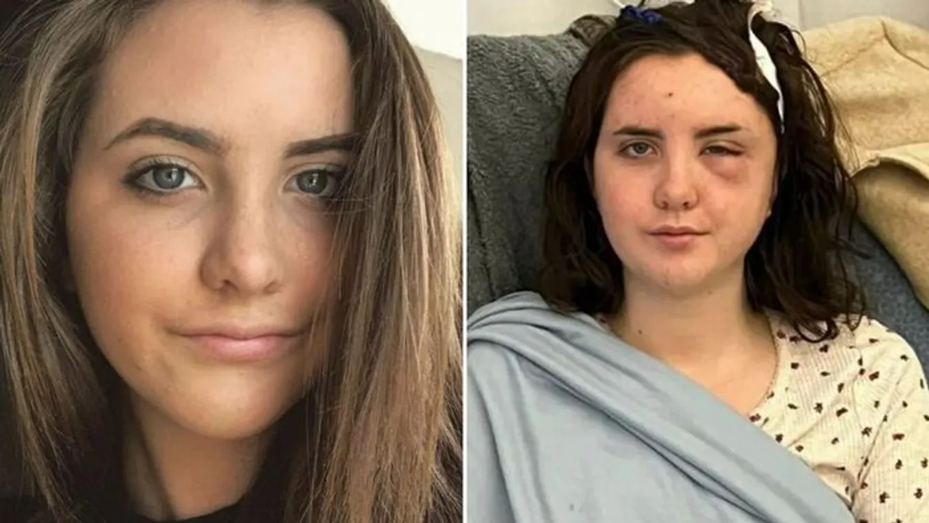 „Nem voltak tüneteim a nyaralásig”