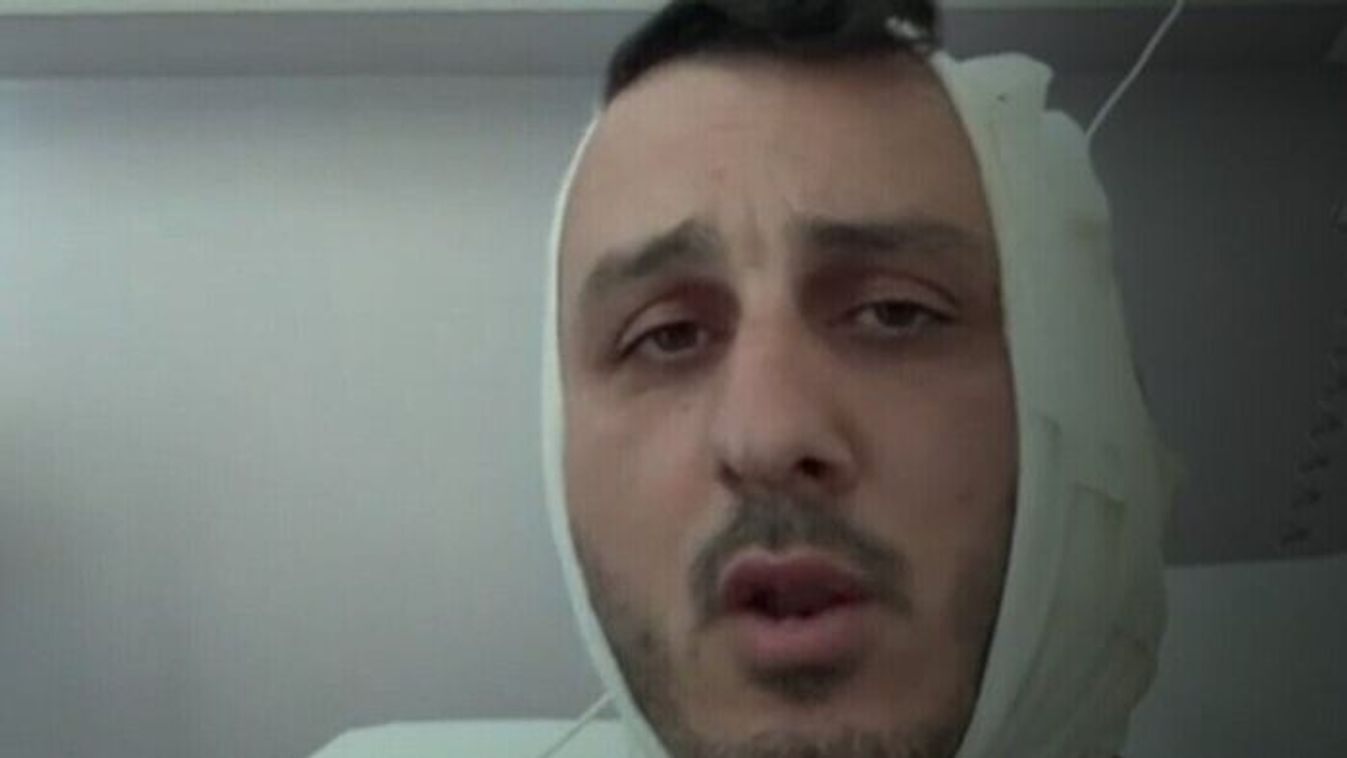 Leharapta az izraeli turista fülét egy szír migráns Görögországban