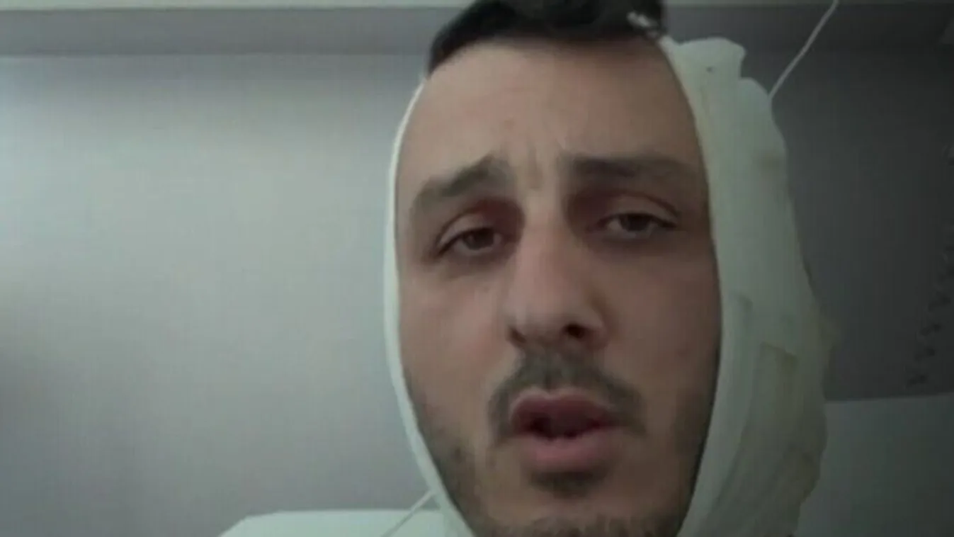 Leharapta az izraeli turista fülét egy szír migráns