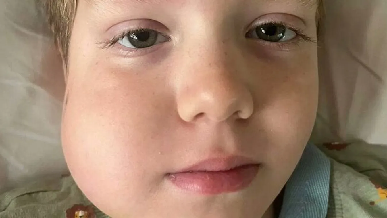 Mozgott a 7 éves kisfiú foga, kiderült rákkal küzd