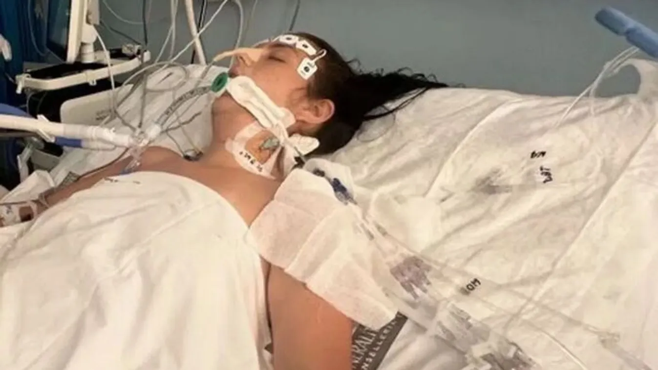 Tetoválással kezdődött, kómával végződött a csajos nyaralás