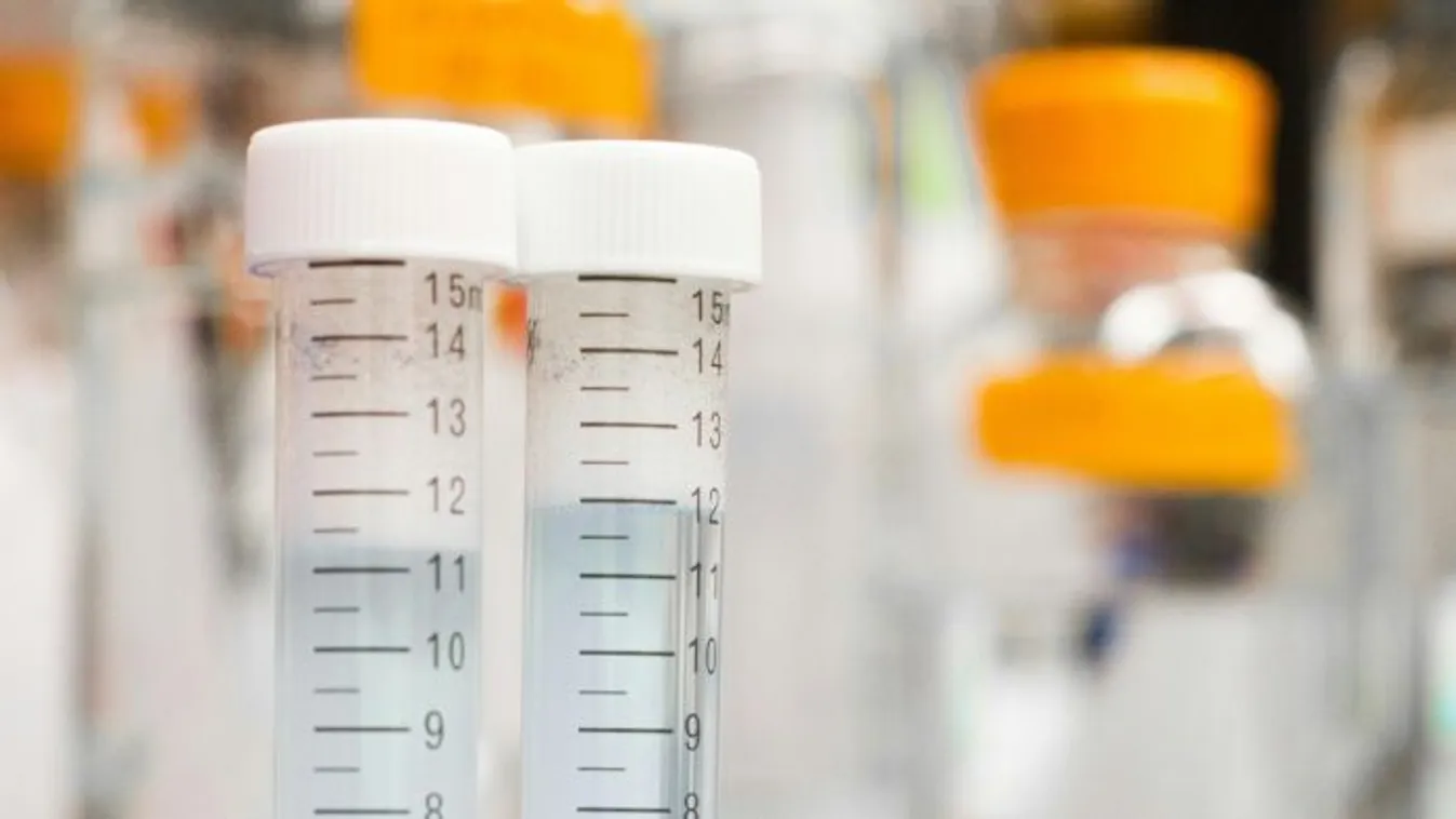 Legionella baktérium egy tátrai hotel pezsgőfürdőjében