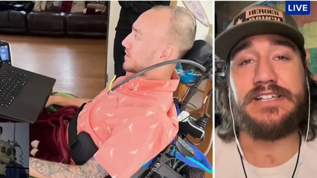 Hihetetlen képességekre tett szert a Neuralink chip miatt