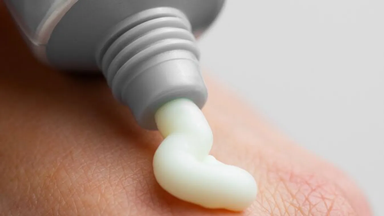 Krém okozta kálvária – „Le akartam tépni a bőröm!”