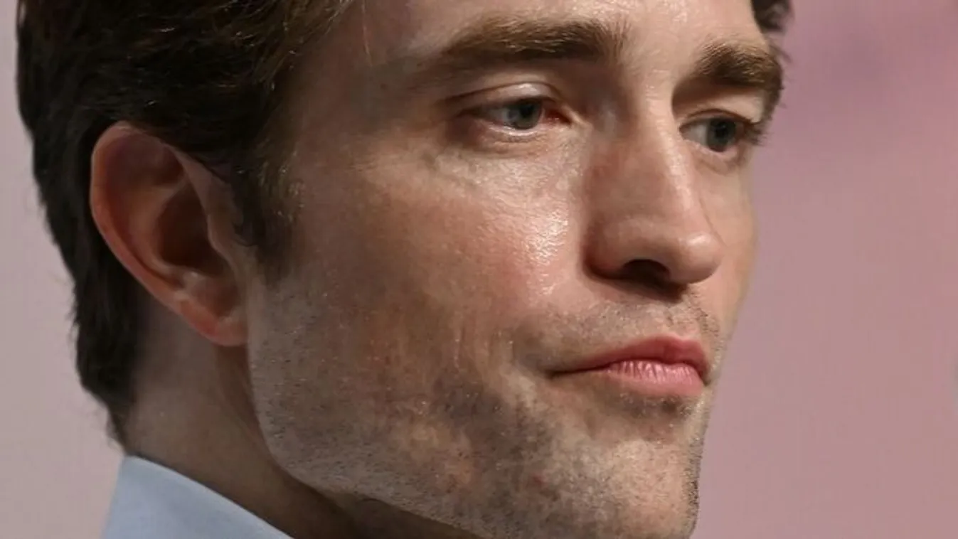 Robert Pattinson párja kórházba került egy túl szoros nadrág miatt