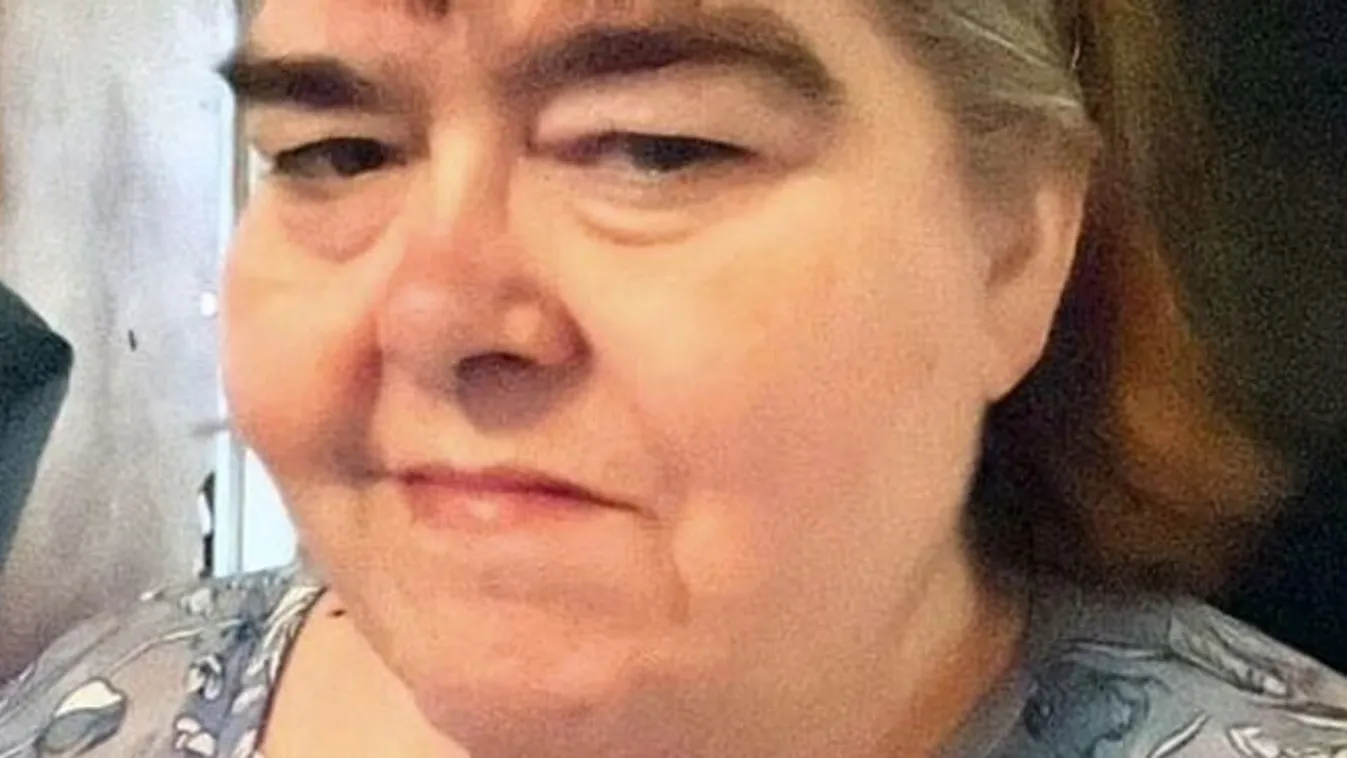  Egy nő elhanyagolta a fiát, amputálni kellett a lábait