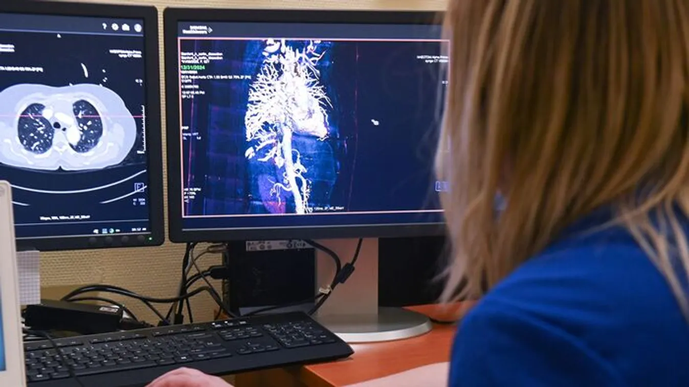 Erre a tünetre figyelj, halálos betegség állhat a háttérben