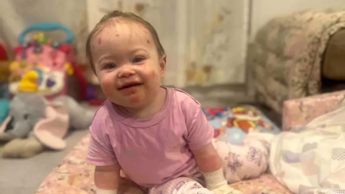 A ritka betegségre most a kislány édesanyja próbálja felhívni a figyelmet.