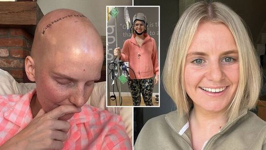 „A harcot választottam” – 27 évesen lett mellrákos Alice, de a háziorvosa elküldte